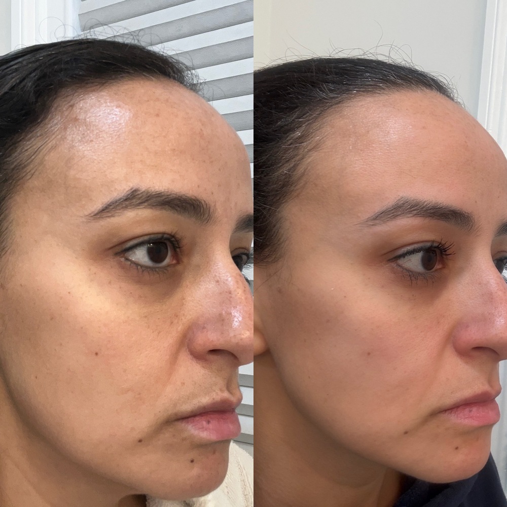 Result shared by Mirna A.