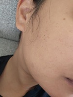 Customer media for review of Deep Vita C Capsule Cream + Detail 1