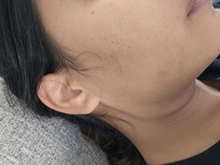 Customer media for review of PDRN Pink Collagen Exosome Shot Ampoule 7500 + Detail 1