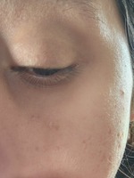 Customer media for review of Revive Eye Serum: Ginseng + Retinal + Detail 1