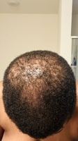 braidbetter in Natural